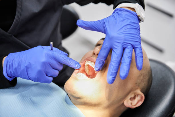 Best Emergency Tooth Extraction  in Spring Valley Lake, CA